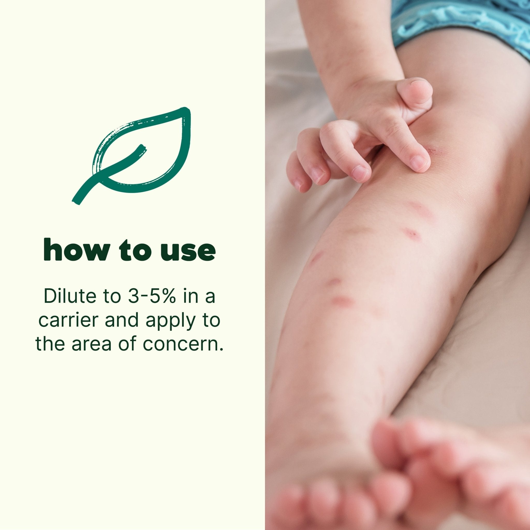 Itch Away Essential Oil Plant Therapy