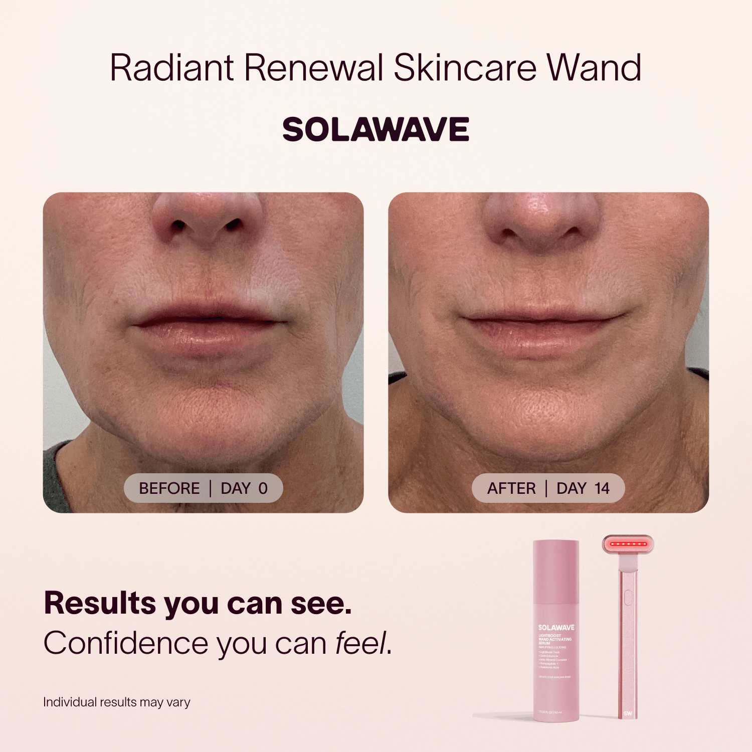 4 - in - 1 Red Light Therapy Wand & Activating Serum Kit Solawave