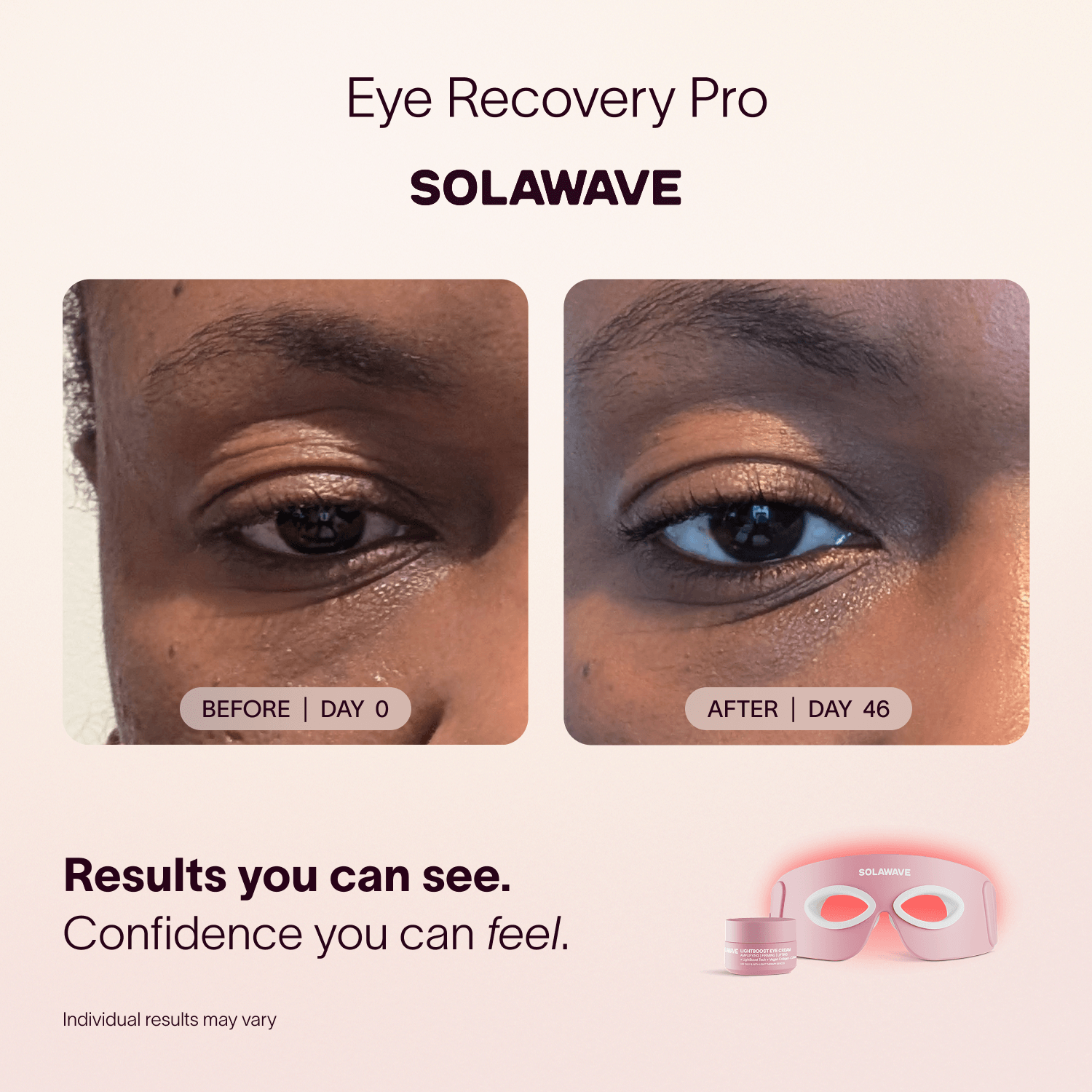 Eye Recovery Pro Kit Solawave
