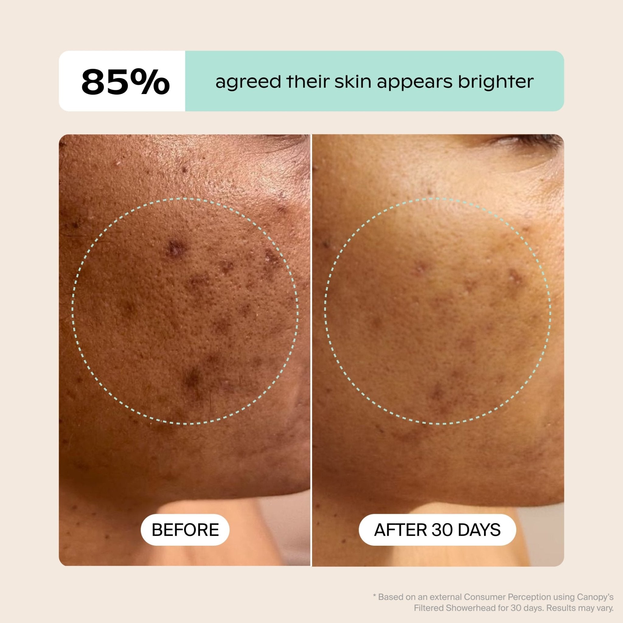 Handheld Filtered Showerhead Canopy