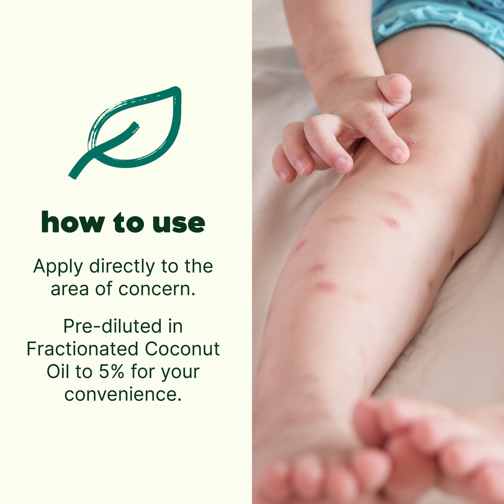 Itch Away Essential Oil Pre - Diluted Roll - On Plant Therapy
