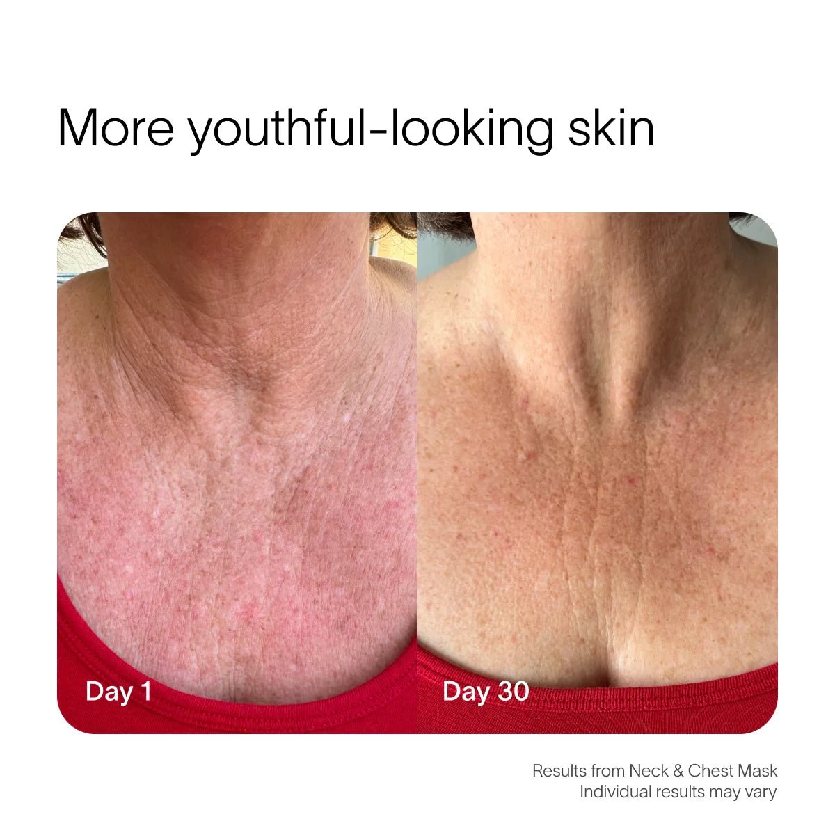 Neck & Chest Rejuvenating Mask Solawave