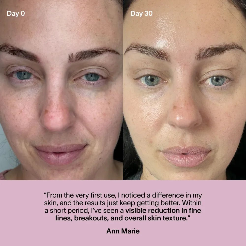 Wrinkle Retreat Face Mask & LightBoost Serum Kit Solawave