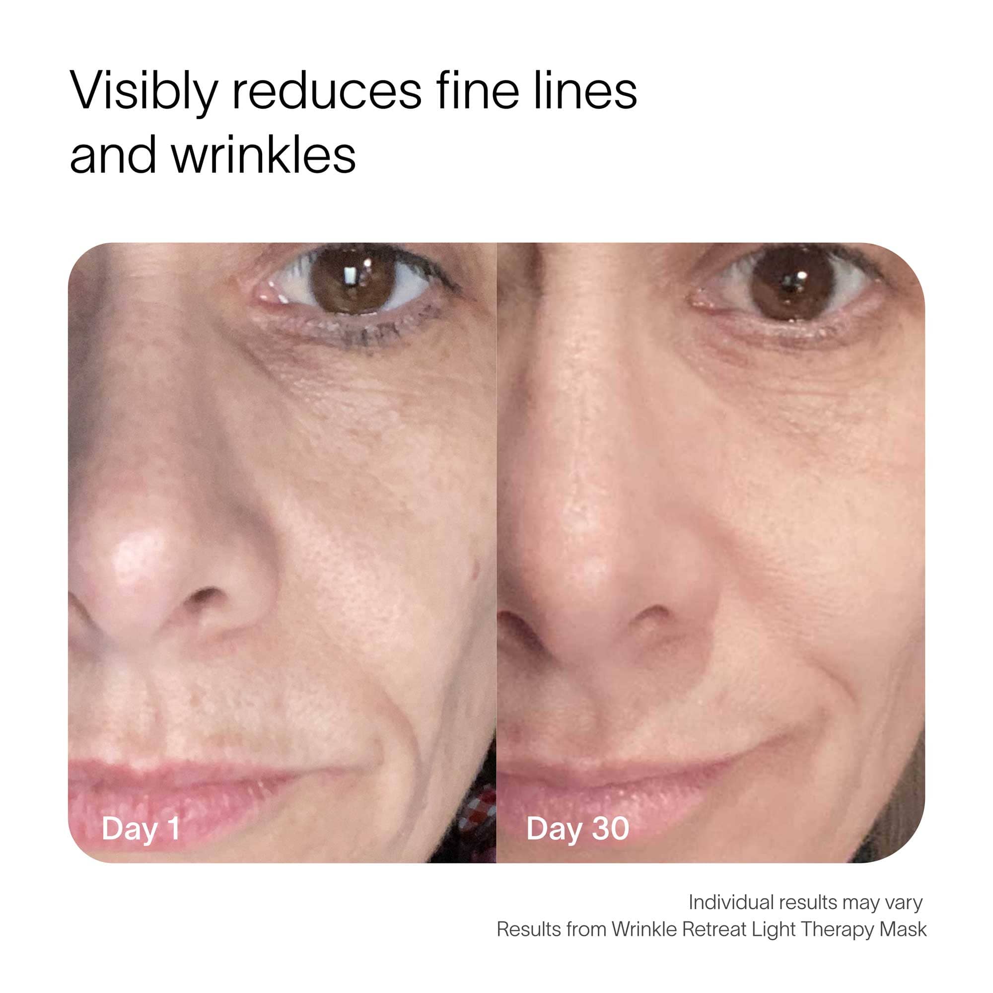 Wrinkle Retreat Red Light Therapy Face Mask Solawave